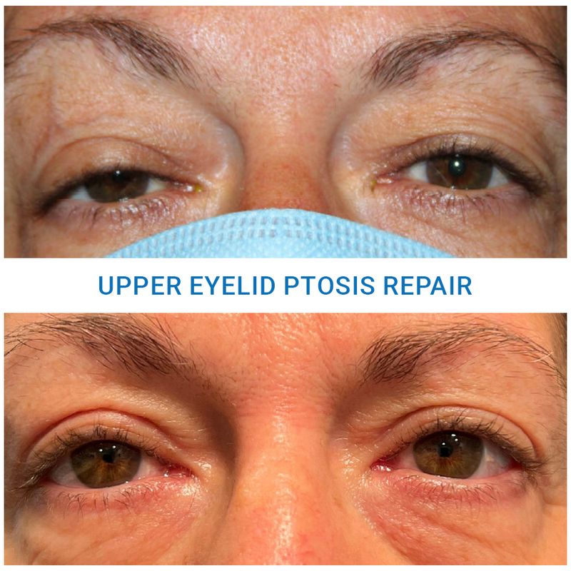 Oculoplastic Nashua Oculoplastic Surgery Manchester Medical Eye