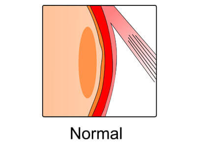 close up diagram of normal macula